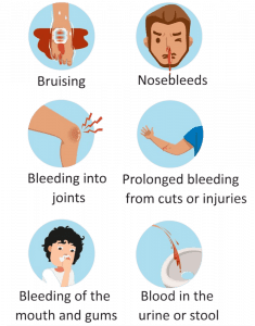 signs and symptoms of hemophilia