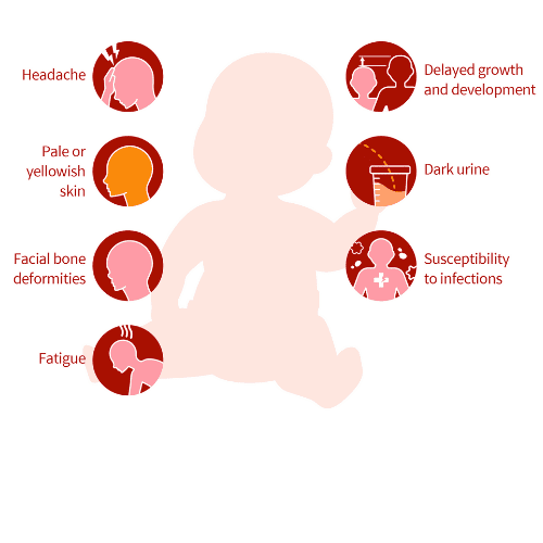 thalassemia symptoms