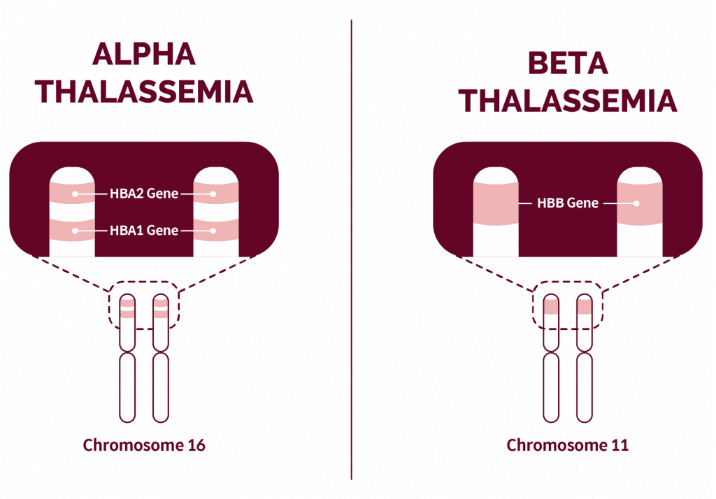 thalassemia types Alpha and Beta