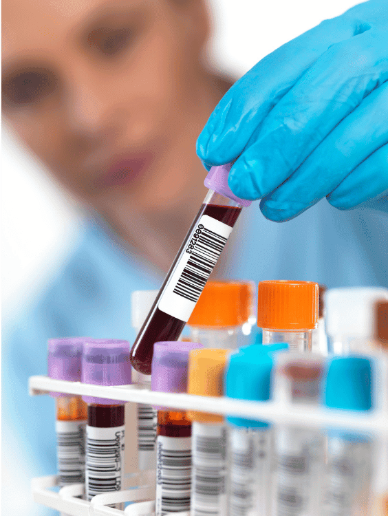 Hemophilia Diagnosis and Treatment